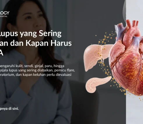 Gejala Lupus yang Sering Diabaikan dan Kapan Harus Tes