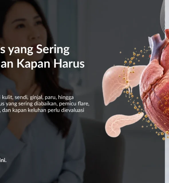 Gejala Lupus yang Sering Diabaikan dan Kapan Harus Tes