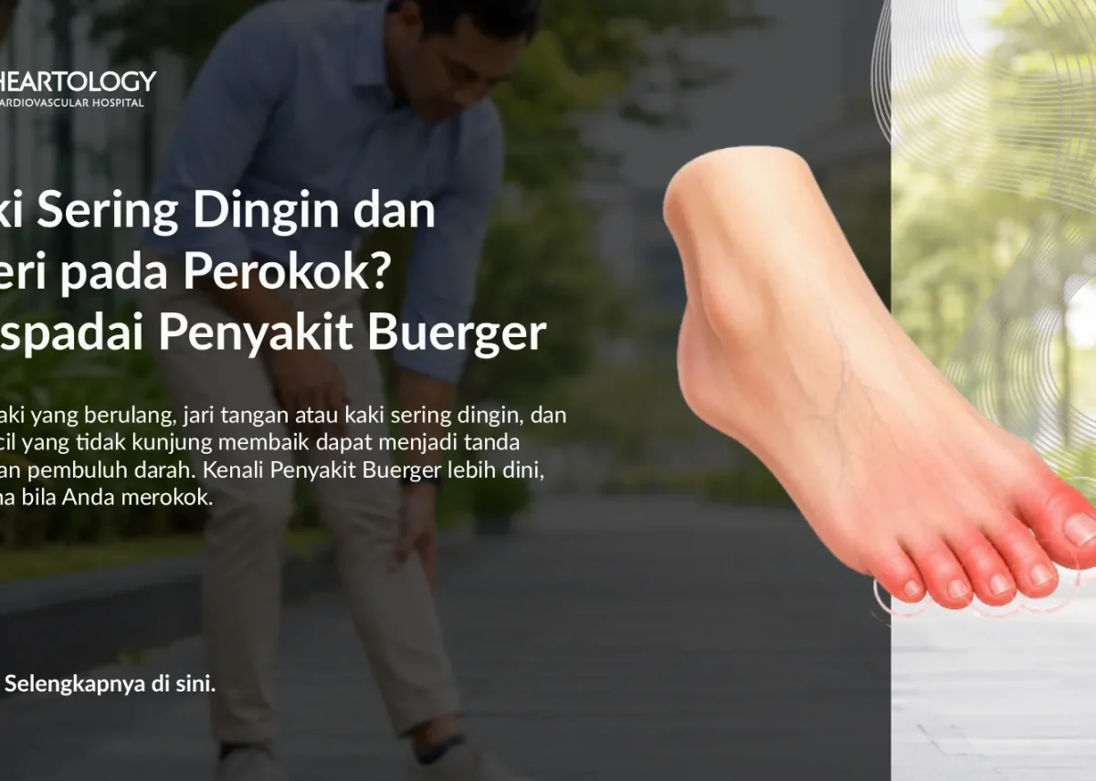Kaki Sering Dingin dan Nyeri pada Perokok? Waspadai Penyakit Buerger