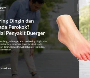 Kaki Sering Dingin dan Nyeri pada Perokok? Waspadai Penyakit Buerger