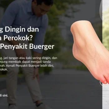 Kaki Sering Dingin dan Nyeri pada Perokok? Waspadai Penyakit Buerger
