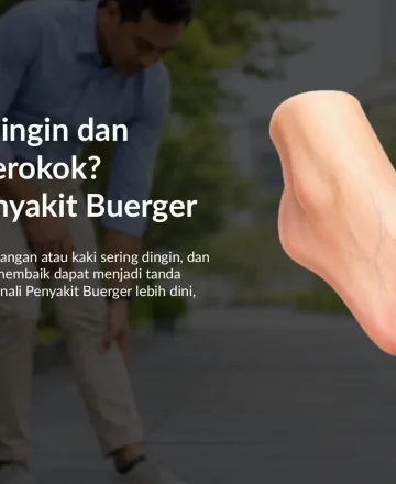 Kaki Sering Dingin dan Nyeri pada Perokok? Waspadai Penyakit Buerger