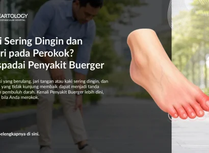 Kaki Sering Dingin dan Nyeri pada Perokok? Waspadai Penyakit Buerger