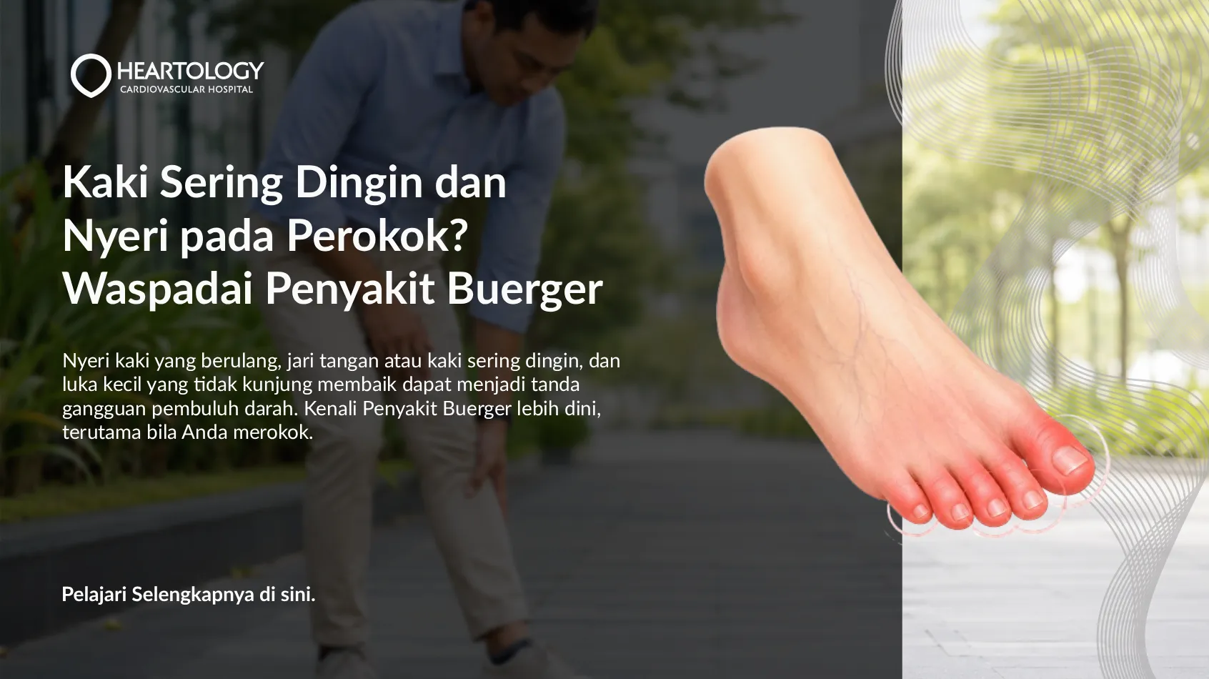 Kaki Sering Dingin dan Nyeri pada Perokok? Waspadai Penyakit Buerger