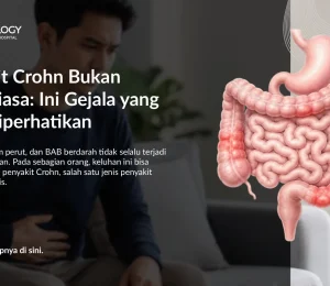 Apa Itu Penyakit Crohn? Gejala, Penyebab & Pengobatan