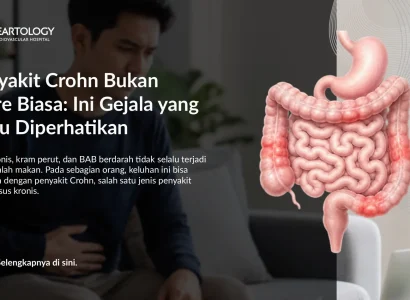 Apa Itu Penyakit Crohn? Gejala, Penyebab & Pengobatan