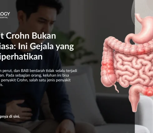 Apa Itu Penyakit Crohn? Gejala, Penyebab & Pengobatan