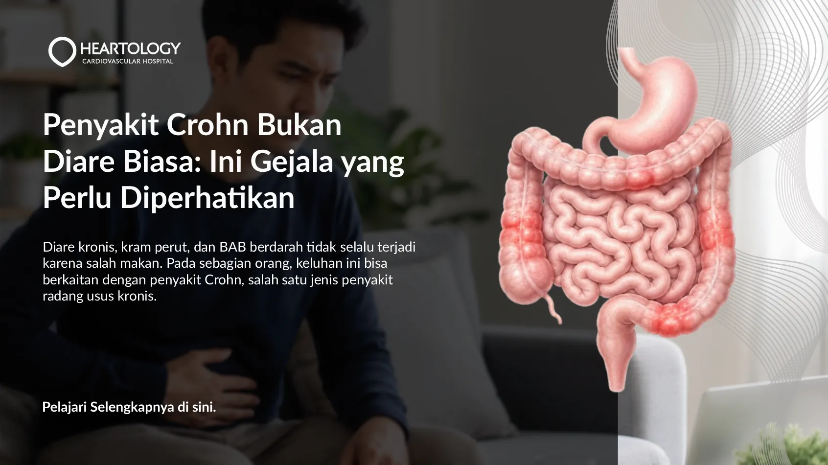 Apa Itu Penyakit Crohn? Gejala, Penyebab & Pengobatan