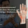 Rheumatoid Arthritis (Rematik Autoimun): Kenali Tanda dan Penanganannya