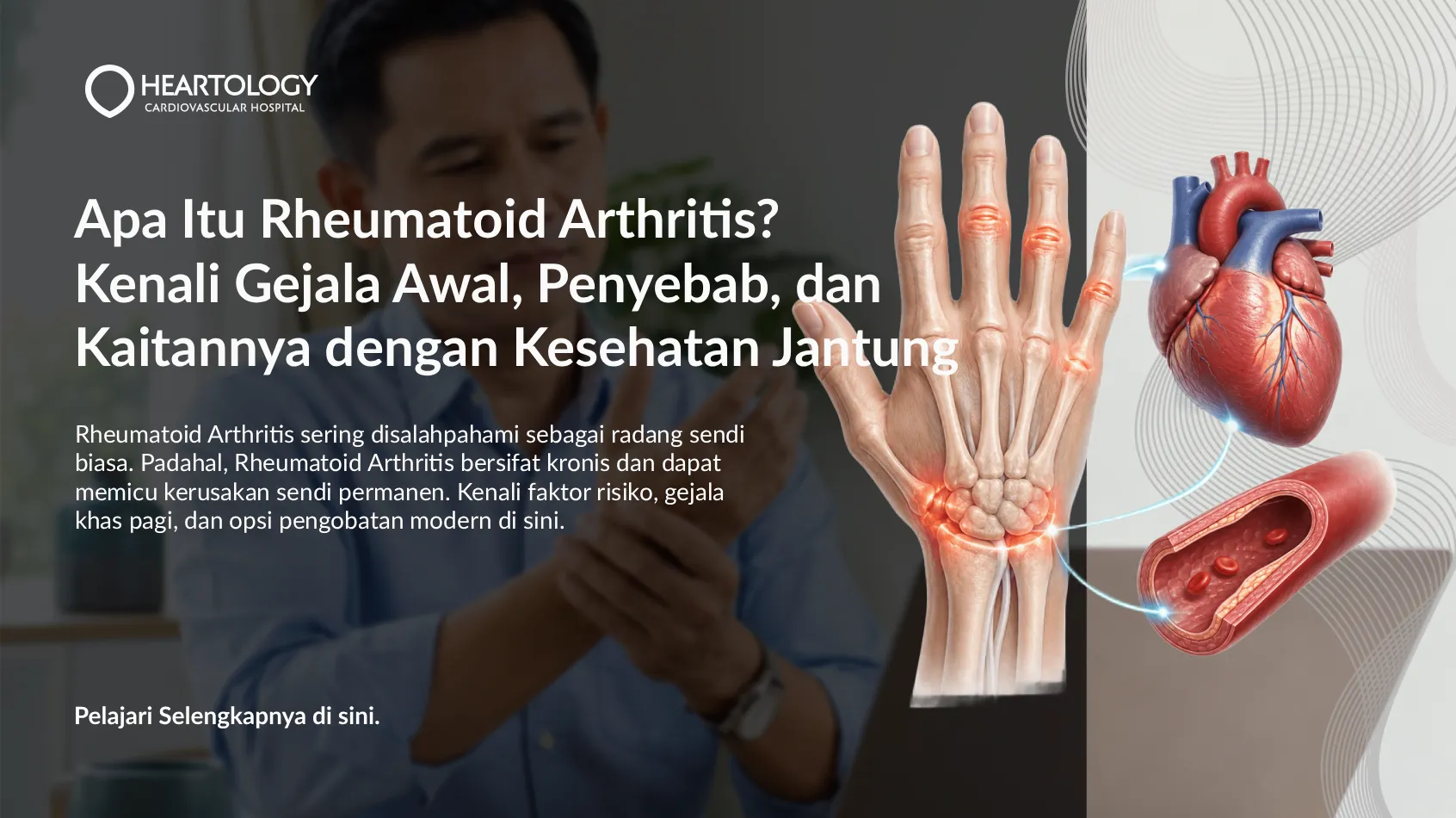 Rheumatoid Arthritis (Rematik Autoimun): Kenali Tanda dan Penanganannya
