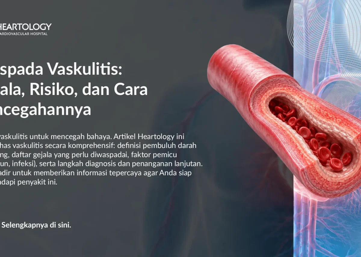 Waspadai Vaskulitis: Gejala Dini & Cara Mencegah