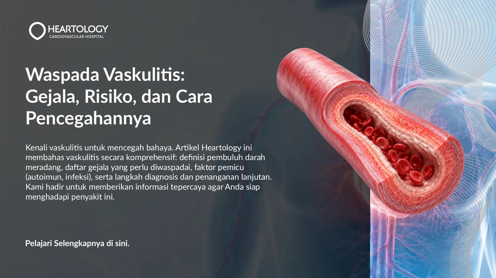 Waspadai Vaskulitis: Gejala Dini & Cara Mencegah
