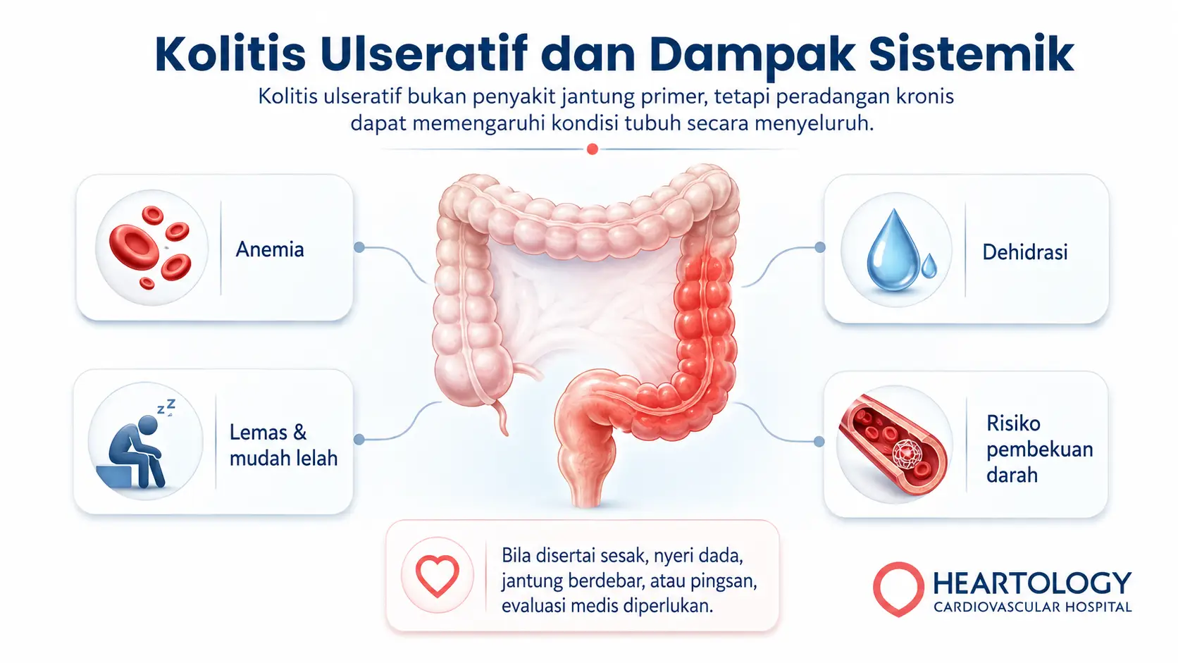 Infografik medis Heartology tentang kolitis ulseratif dan dampak sistemik pada tubuh, menampilkan usus besar yang meradang dengan penjelasan risiko anemia, dehidrasi, lemas atau mudah lelah, serta risiko pembekuan darah.