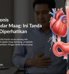 Gastritis Kronis Bukan Sekadar Maag: Ini Tanda yang Perlu Diperhatikan