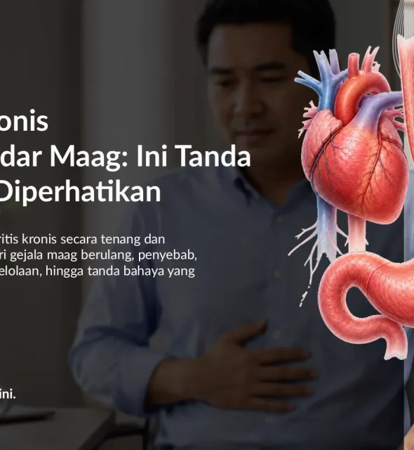 Gastritis Kronis Bukan Sekadar Maag: Ini Tanda yang Perlu Diperhatikan