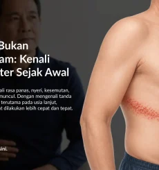 Apa Itu Herpes Zoster? Kenali Gejala Cacar Ular dan Kaitannya dengan Kesehatan Jantung