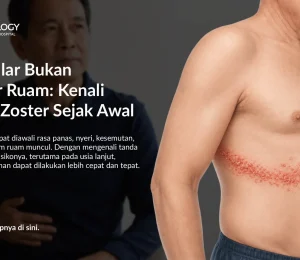 Apa Itu Herpes Zoster? Kenali Gejala Cacar Ular dan Kaitannya dengan Kesehatan Jantung