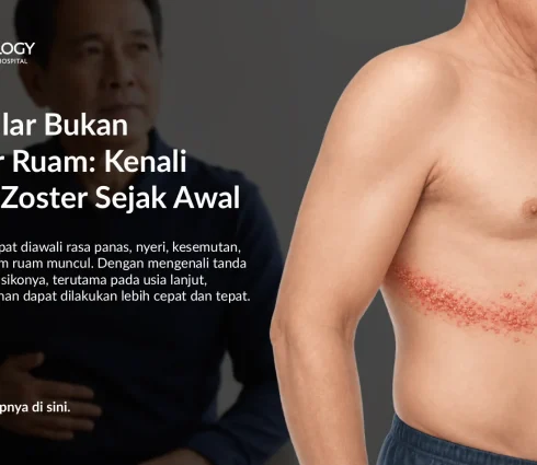 Apa Itu Herpes Zoster? Kenali Gejala Cacar Ular dan Kaitannya dengan Kesehatan Jantung