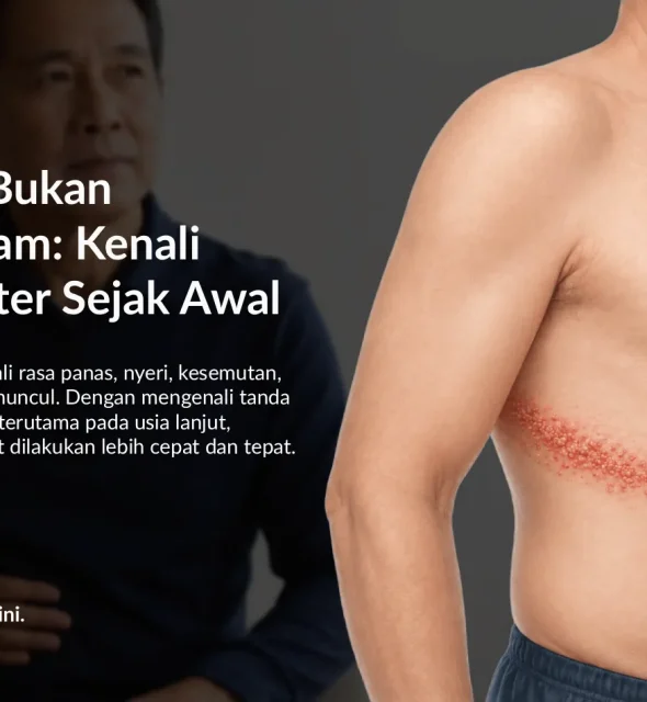 Apa Itu Herpes Zoster? Kenali Gejala Cacar Ular dan Kaitannya dengan Kesehatan Jantung