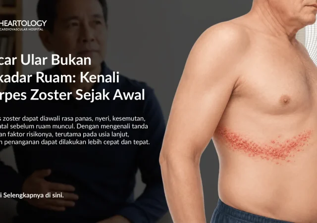 Apa Itu Herpes Zoster? Kenali Gejala Cacar Ular dan Kaitannya dengan Kesehatan Jantung