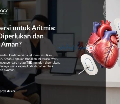 Kardioversi untuk Aritmia: Kapan Diperlukan dan Apakah Aman?