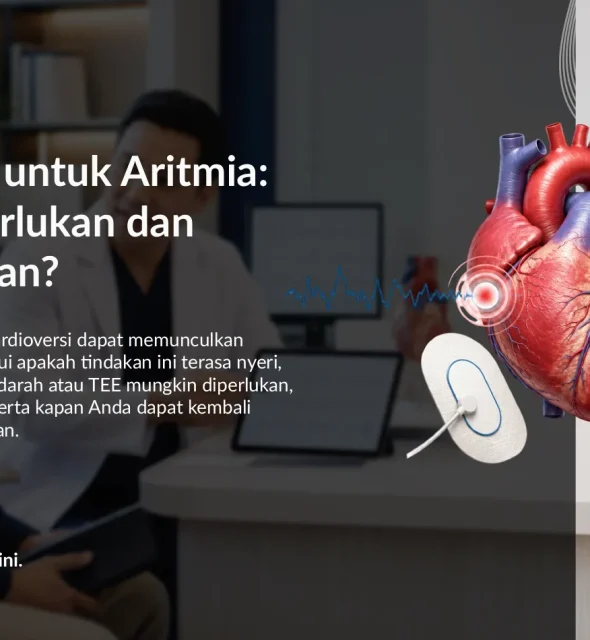 Kardioversi untuk Aritmia: Kapan Diperlukan dan Apakah Aman?