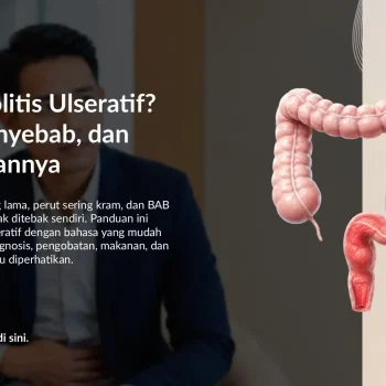 Kolitis Ulseratif: Gejala, Penyebab, Pemeriksaan, dan Pengobatan