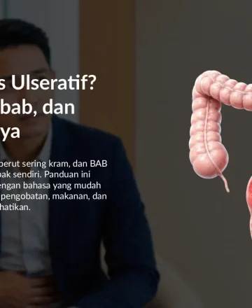 Kolitis Ulseratif: Gejala, Penyebab, Pemeriksaan, dan Pengobatan