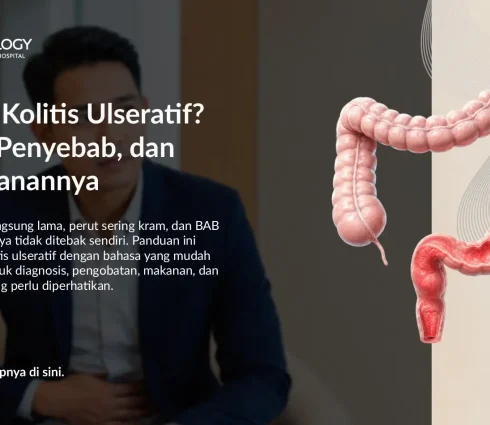 Kolitis Ulseratif: Gejala, Penyebab, Pemeriksaan, dan Pengobatan
