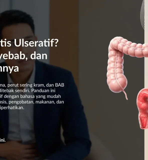 Kolitis Ulseratif: Gejala, Penyebab, Pemeriksaan, dan Pengobatan