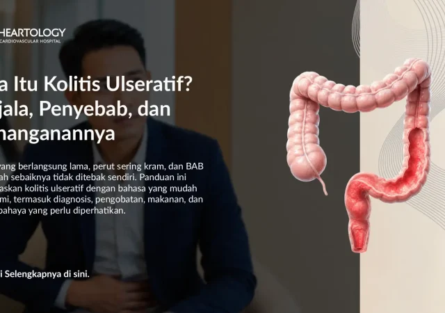 Kolitis Ulseratif: Gejala, Penyebab, Pemeriksaan, dan Pengobatan