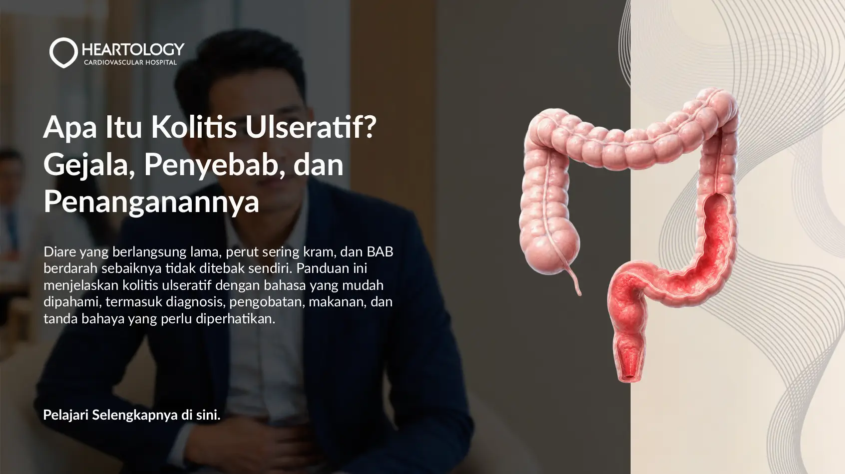 Kolitis Ulseratif: Gejala, Penyebab, Pemeriksaan, dan Pengobatan