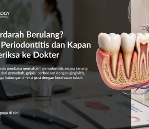 Hubungan antara Periodontitis dan Penyakit Jantung