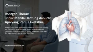 Rontgen Thorax untuk Menilai Jantung dan Paru: Apa yang Perlu Diketahui?
