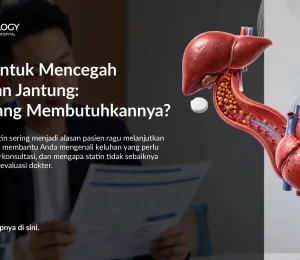 Statin untuk Mencegah Serangan Jantung: Siapa yang Membutuhkannya?