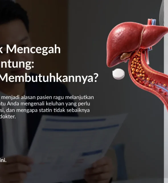 Statin untuk Mencegah Serangan Jantung: Siapa yang Membutuhkannya?