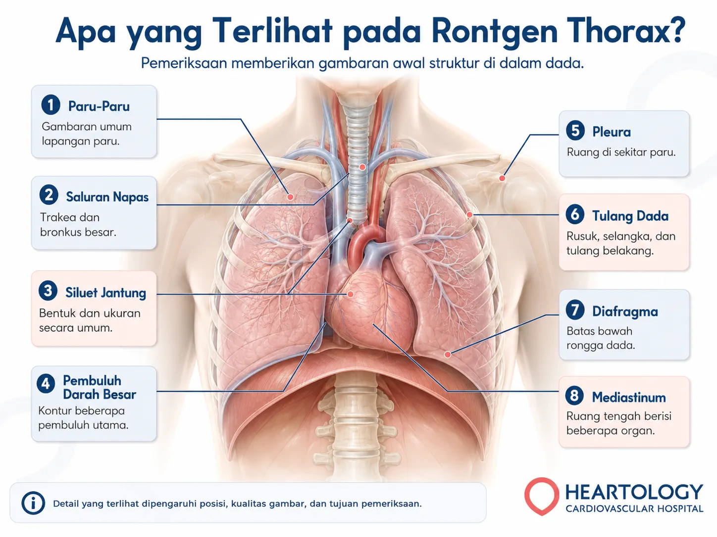 Infografik anatomi dada yang menunjukkan struktur pada rontgen thorax, termasuk paru-paru, trakea, siluet jantung, pembuluh besar, pleura, tulang, diafragma, dan mediastinum.