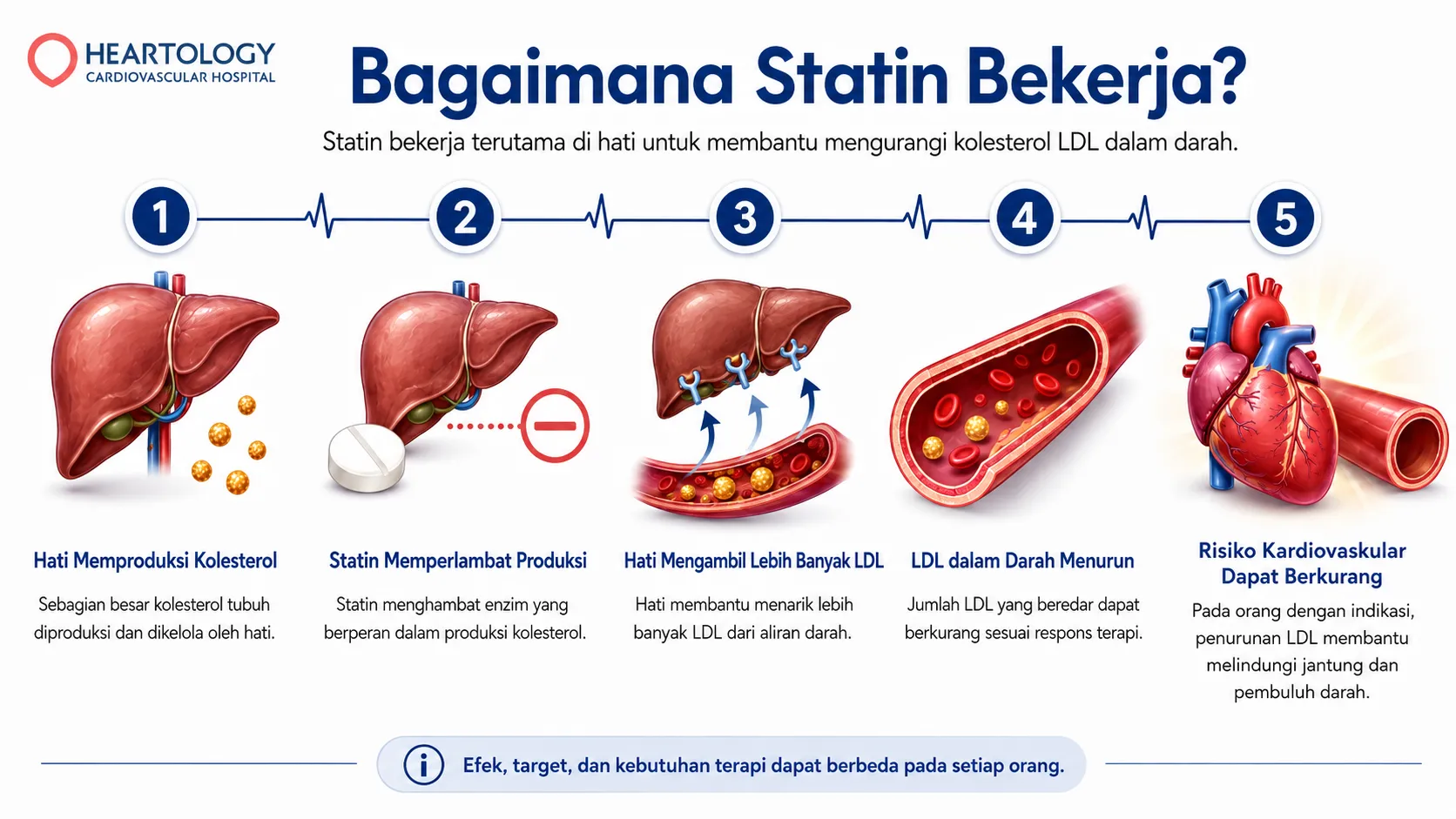 Infografik medis Heartology berjudul “Bagaimana Statin Bekerja?” yang menampilkan lima langkah kerja statin, mulai dari produksi kolesterol di hati, perlambatan produksi kolesterol, pengambilan LDL oleh hati, penurunan LDL dalam darah, hingga potensi penurunan risiko kardiovaskular. 