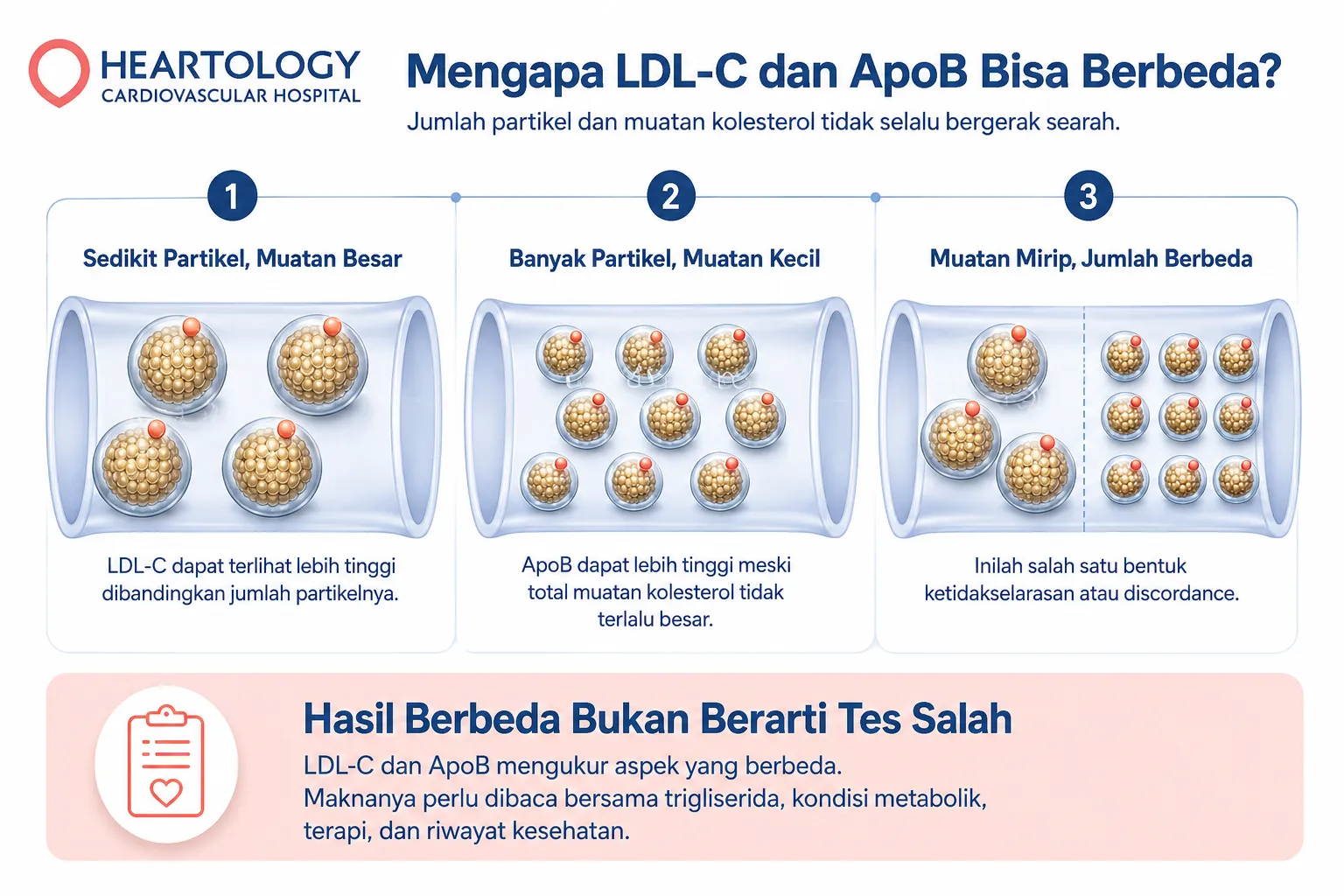 Infografik medis Heartology tentang perbedaan LDL-C dan ApoB, menampilkan tiga skenario jumlah partikel lipoprotein dan muatan kolesterol yang tidak selalu bergerak searah.