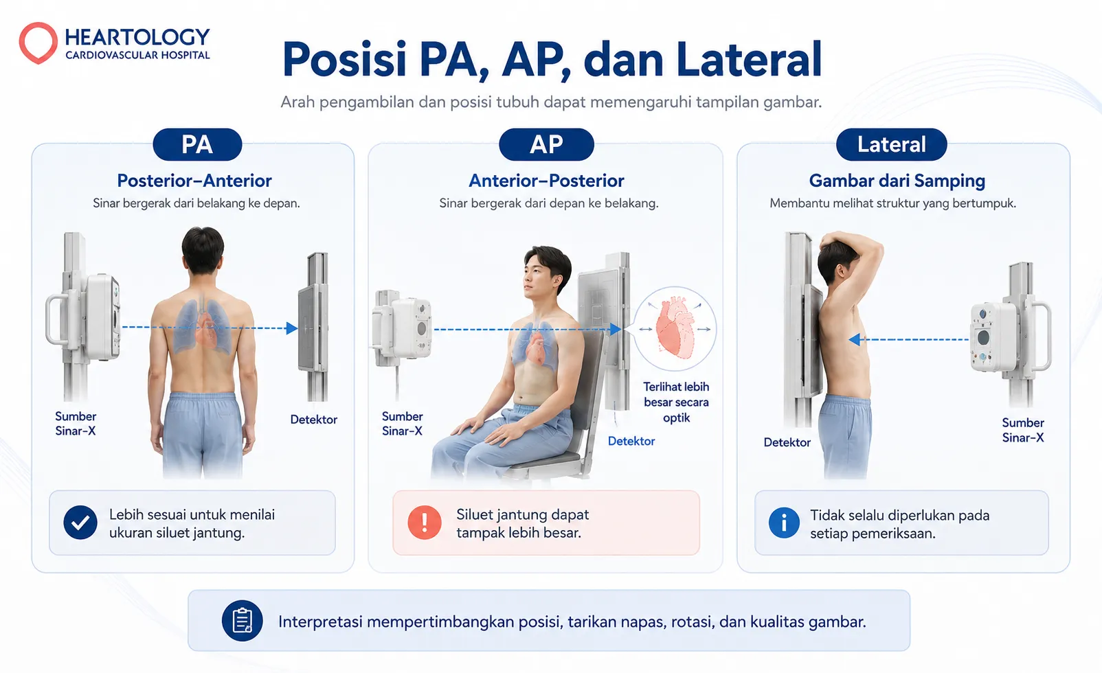 Infografik posisi PA, AP, dan lateral pada rontgen thorax yang menunjukkan arah sinar-X, posisi pasien, letak detektor, dan perbedaan tampilan gambar.