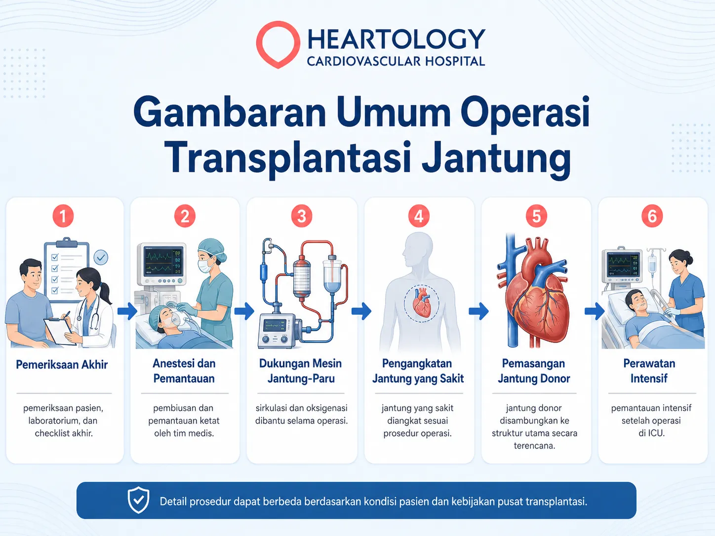 Infografik enam tahap operasi transplantasi jantung, meliputi pemeriksaan akhir, anestesi, mesin jantung-paru, pengangkatan jantung sakit, pemasangan jantung donor, dan perawatan intensif. 