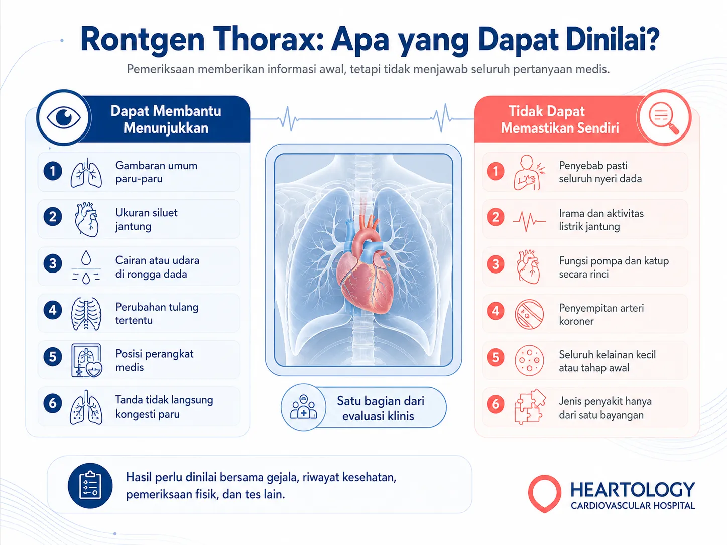 Infografik kemampuan dan keterbatasan rontgen thorax dalam menilai paru-paru, siluet jantung, rongga dada, tulang, dan posisi perangkat medis.