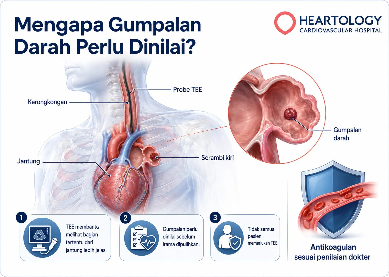 Ilustrasi anatomi medis yang menunjukkan hubungan jantung, kerongkongan, dan probe TEE untuk menilai gumpalan darah di serambi kiri sebelum kardioversi, serta peran antikoagulan sesuai penilaian dokter. 