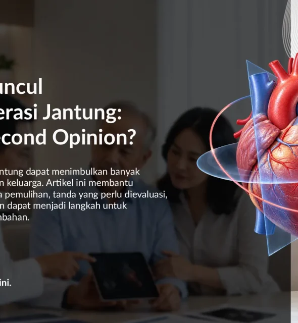 Keluhan Setelah Operasi Jantung: Perlukah Second Opinion?