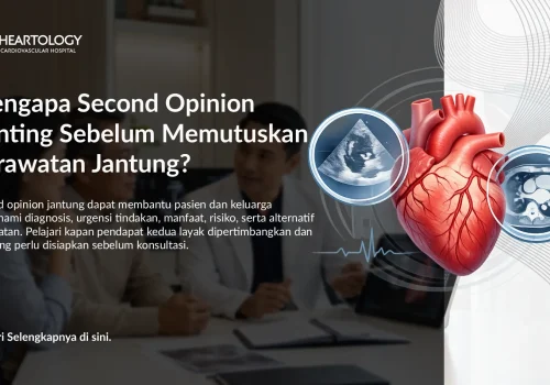 Mengapa Second Opinion Penting Sebelum Memutuskan Perawatan Jantung?