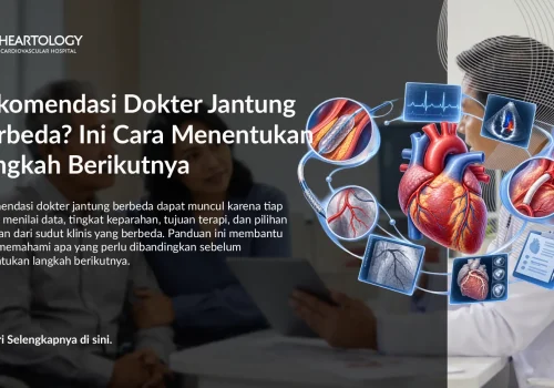 Rekomendasi Dokter Jantung Berbeda? Ini Cara Menentukan Langkah Berikutnya