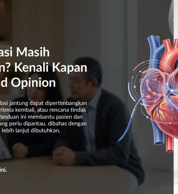 Setelah Ablasi Masih Ada Keluhan? Kenali Kapan Perlu Second Opinion