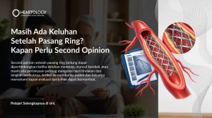 Masih Ada Keluhan Setelah Pasang Ring? Kapan Perlu Second Opinion