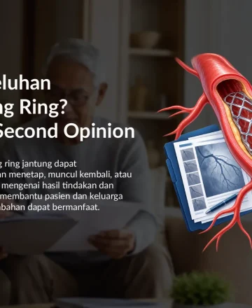 Masih Ada Keluhan Setelah Pasang Ring? Kapan Perlu Second Opinion