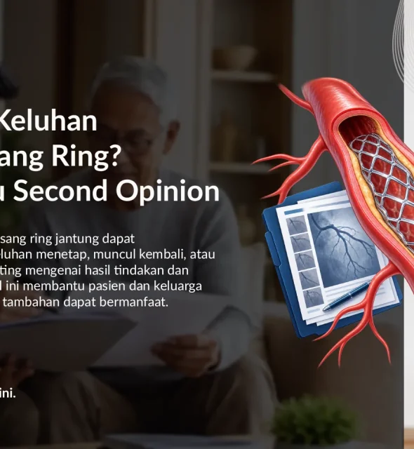 Masih Ada Keluhan Setelah Pasang Ring? Kapan Perlu Second Opinion